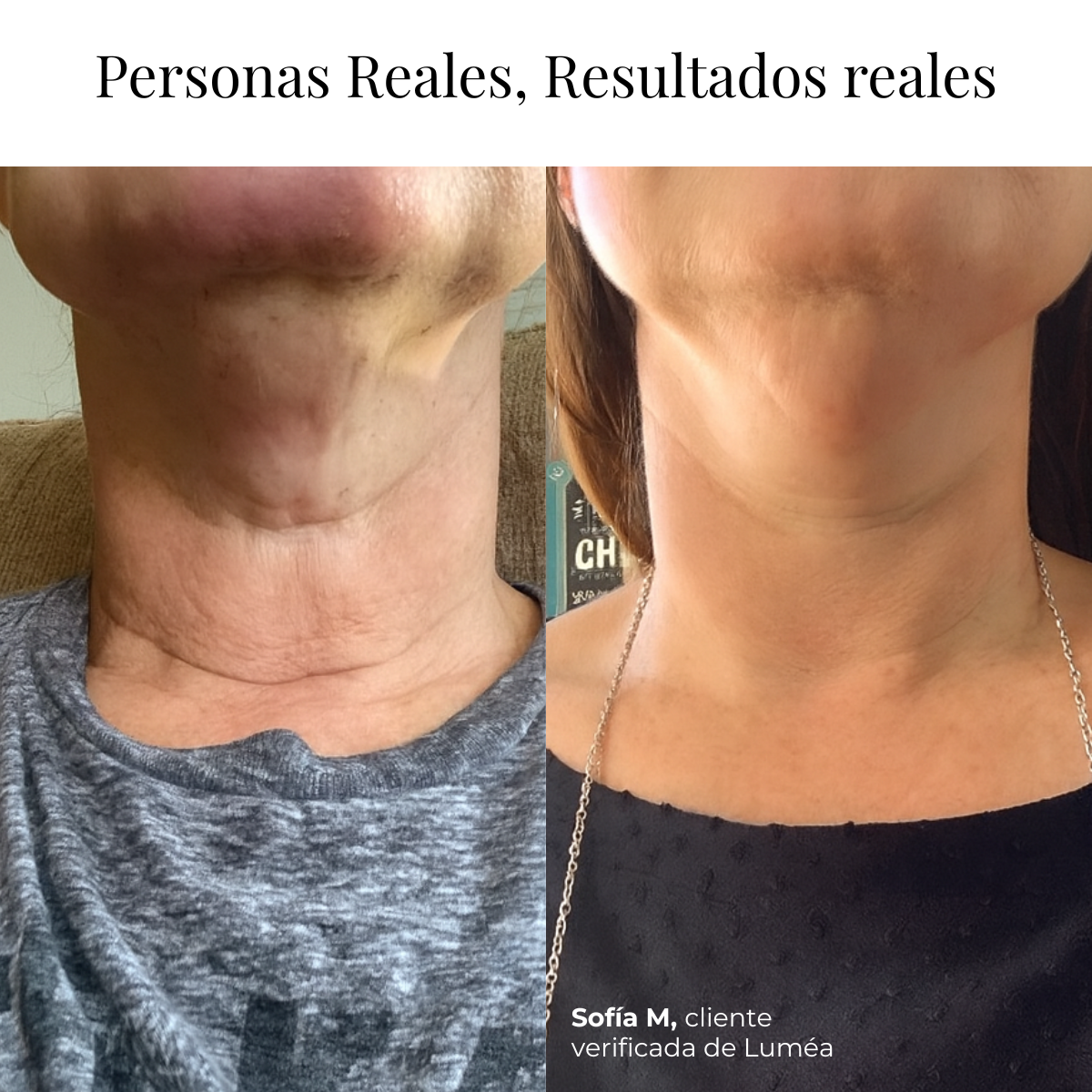 Lifting Neck Cream